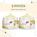 ODALIT™ Vein Therapy Cream - Creme Redutor De Varizes