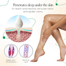 ODALIT™ Vein Therapy Cream - Creme Redutor De Varizes