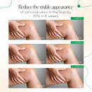 ODALIT™ Vein Therapy Cream - Creme Redutor De Varizes