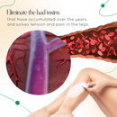 ODALIT™ Vein Therapy Cream - Creme Redutor De Varizes