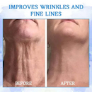 SkinFirmX Fubsta