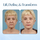 VDefine Lifting Tape