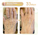 Lefun® SkinFirm Pro