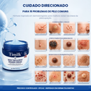 BlueMaster - Removedor de Verrugas