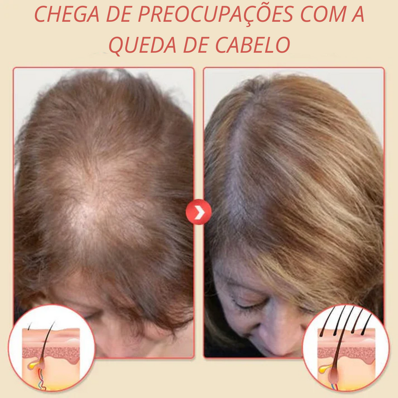 Shampoo de espuma para regeneração capilar