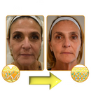 Furzero™ Botox Bee Venom