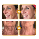 Furzero™ Botox Bee Venom