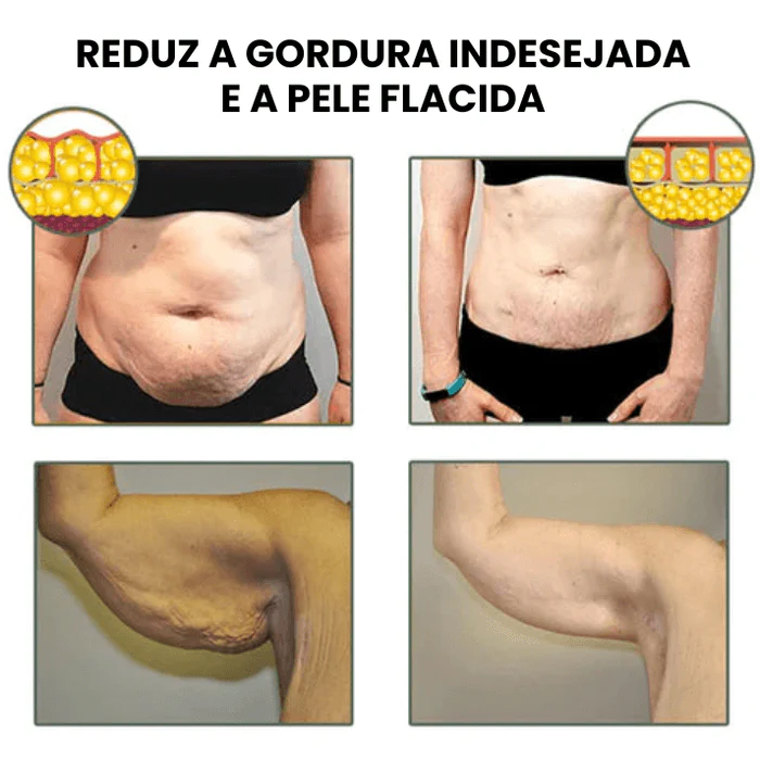 SlimFit Redutor De Medidas