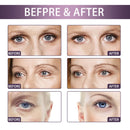 Olhos Enriquecidos DermaEye Renew