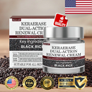 BioClear Skin - Creme removedor de Verrugas