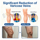 Adesivo de tratamento com microagulhas VeinEase