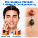 Clarivex Patch - remoção de acne e verrugas | Remove Verrugas Salientes, Acne, Verrugas Planas e Marcas de Pele | Ajuda a Melhorar Rugas, Cicatrizes e Imperfeições | Adesivos Invisíveis para Rosto e Corpo