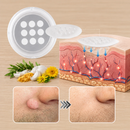 Clarivex Patch - remoção de acne e verrugas | Remove Verrugas Salientes, Acne, Verrugas Planas e Marcas de Pele | Ajuda a Melhorar Rugas, Cicatrizes e Imperfeições | Adesivos Invisíveis para Rosto e Corpo