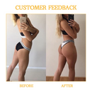 Gold Luxe levantamento de bumbum