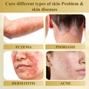 Condense DermaVenom