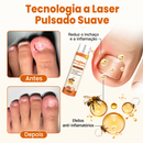 Nailuxe Repair - Spray reparador de unhas
