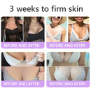 Aurevix PDRN | Creme Corporal Firmador com Massageador 5D