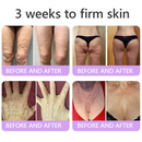Aurevix PDRN | Creme Corporal Firmador com Massageador 5D