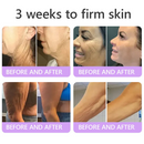 Aurevix PDRN | Creme Corporal Firmador com Massageador 5D
