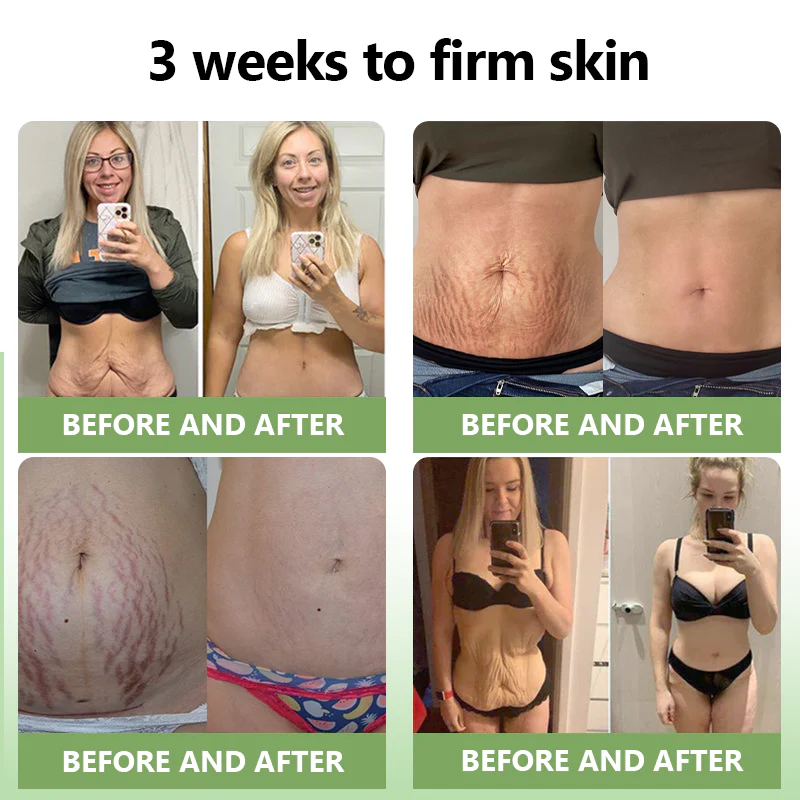 TLOPA® Luxurious Collagen Firming Cream