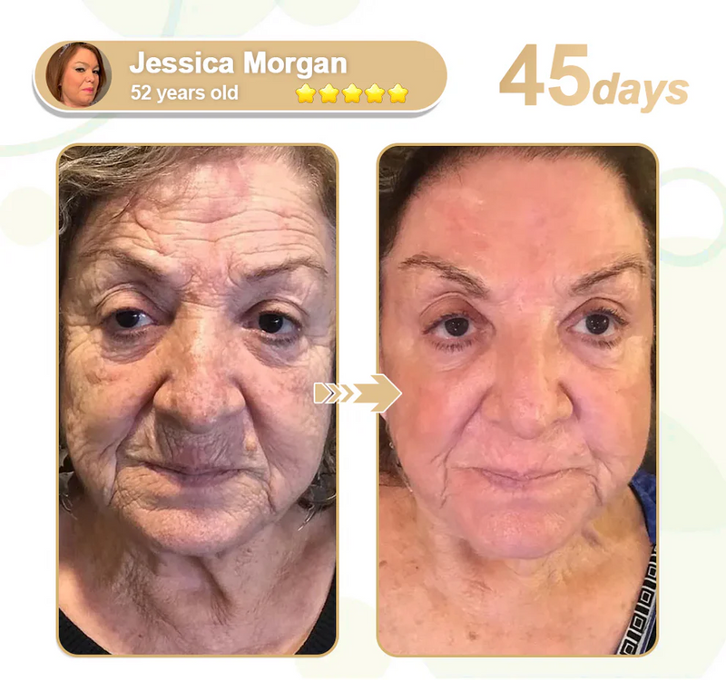 Lefun® SkinFirm Pro