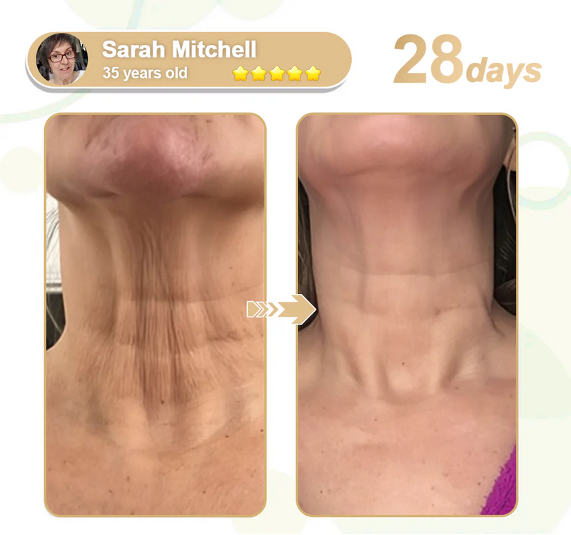 Lefun® SkinFirm Pro