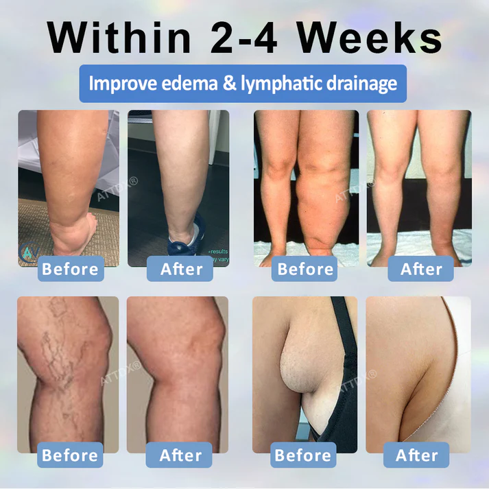 ByeBye Inchaço - Creme Desintoxicante