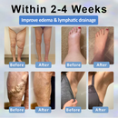 ATTDX® VenoCalm – Creme Drenante e Desintoxicante