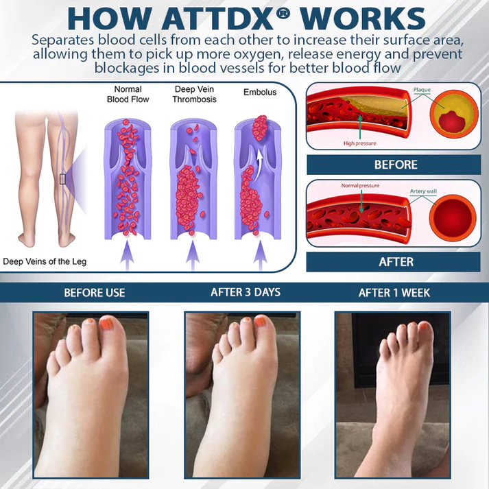 ATTDX® VenoCalm – Creme Drenante e Desintoxicante