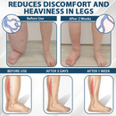 ATTDX® VenoCalm – Creme Drenante e Desintoxicante