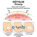 Adesivo Corretor De Unha